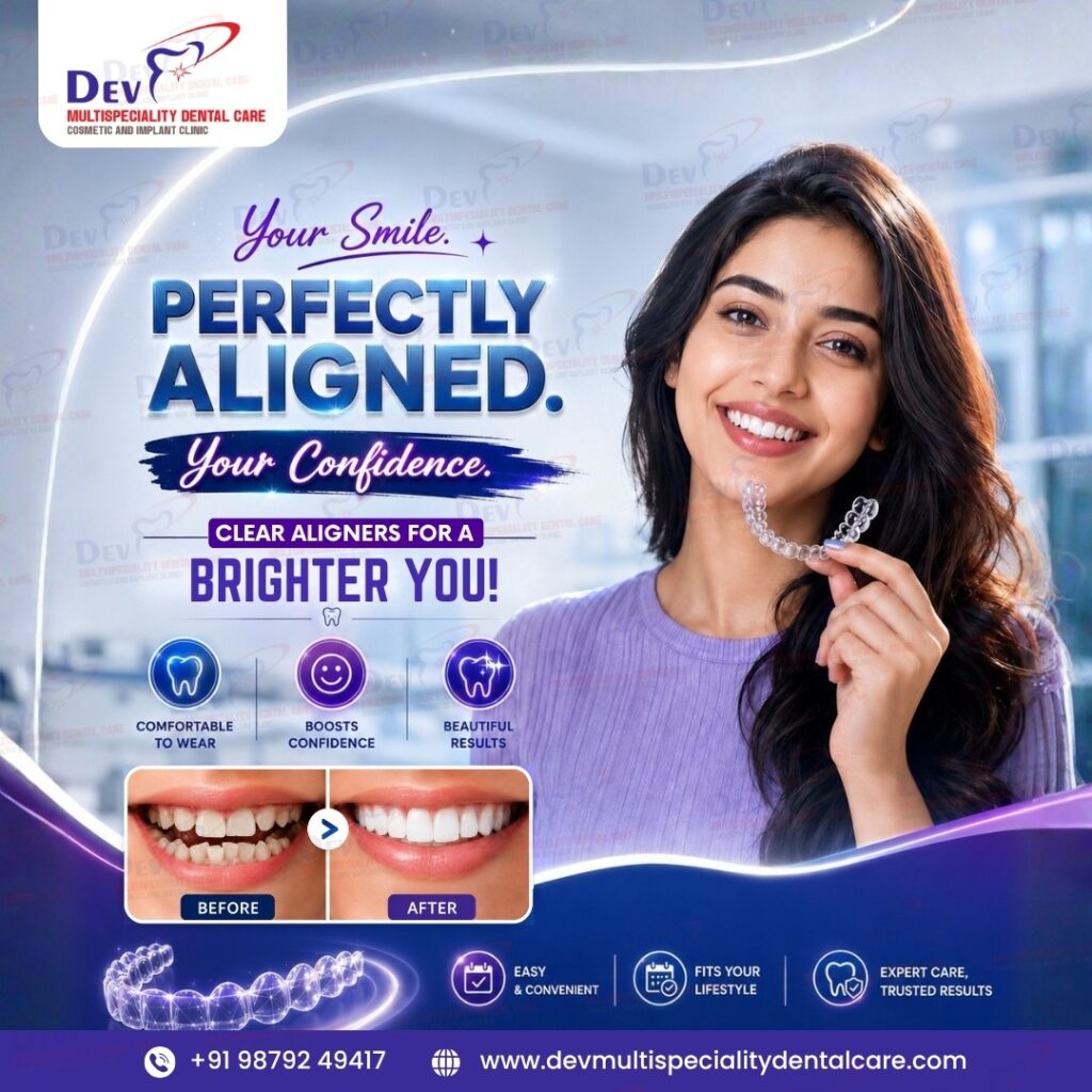 perfect aligners.jpeg