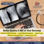Chest-X-Ray-in-Ahmedabad.jpg
