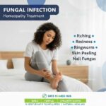 fungal infection 2.jpg